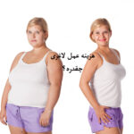 هزینه عمل لاغری