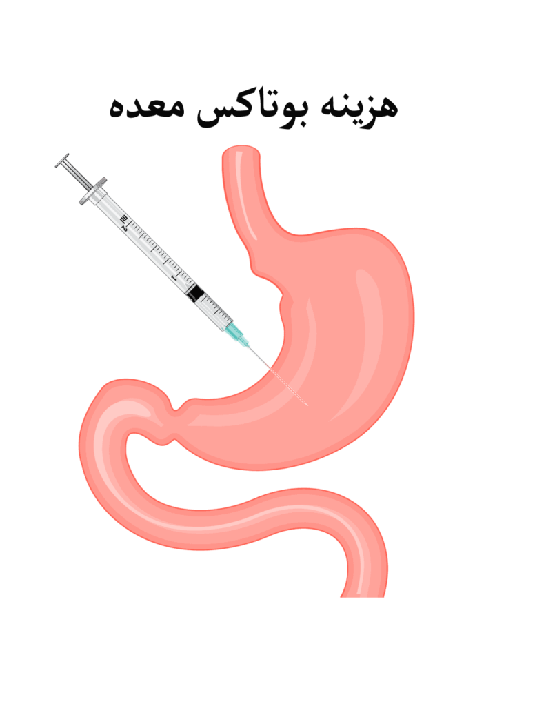 هزینه بوتاکس معده