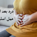 درد بعد از عمل اسلیو