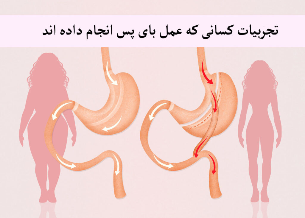 تجربیات کسانی که عمل بای پس انجام داده اند