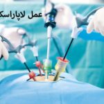 جراحی لاپاراسکوپی