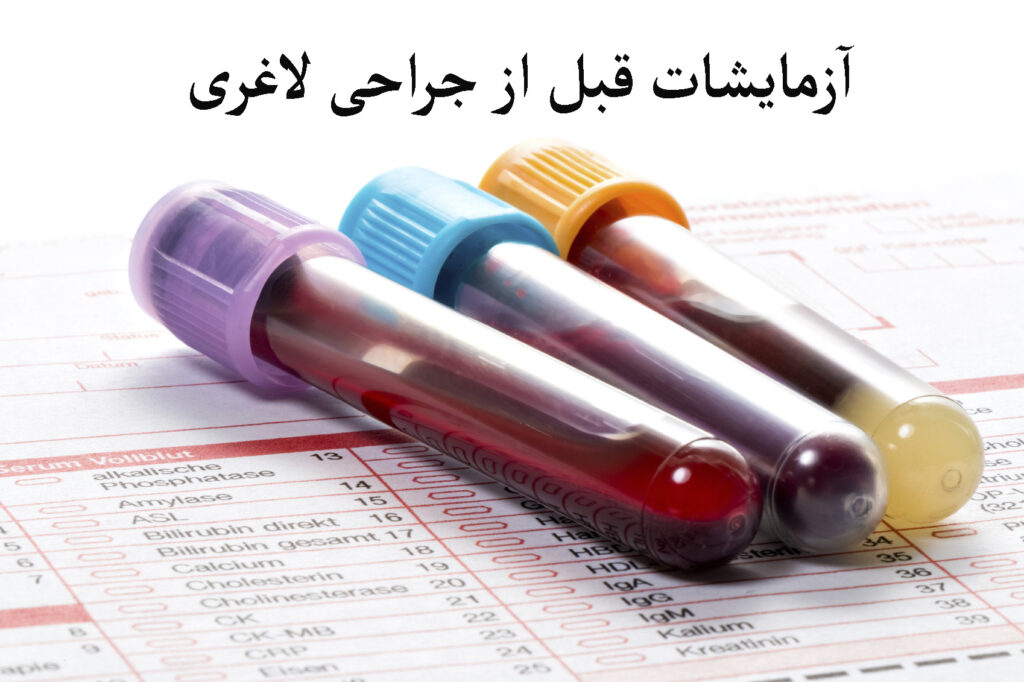 آزمایش های قبل از عمل لاغری