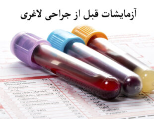 آزمایش های قبل از عمل لاغری
