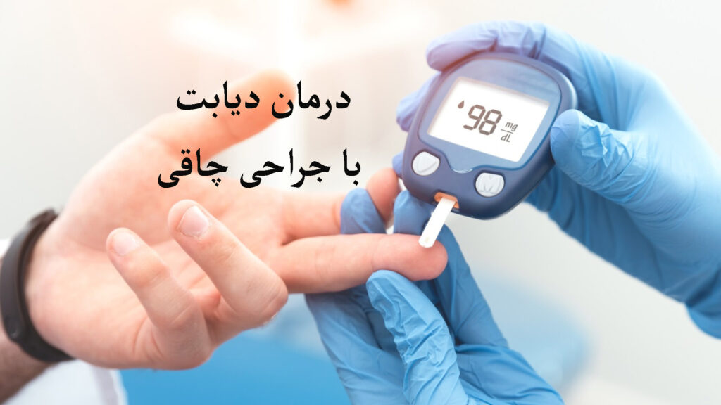 درمان دیابت با جراحی چاقی