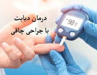 درمان دیابت با جراحی چاقی