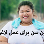 بهترین سن برای عمل لاغری