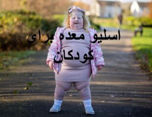 اسلیو معده کودکان