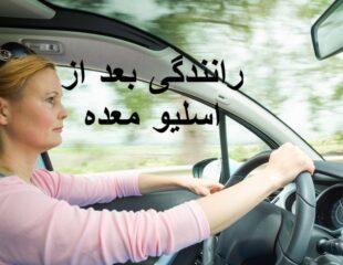 رانندگی بعد از اسلیو معده