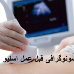 سونوگرافی قبل از عمل اسلیو معده