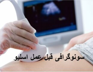 سونوگرافی قبل از عمل اسلیو معده