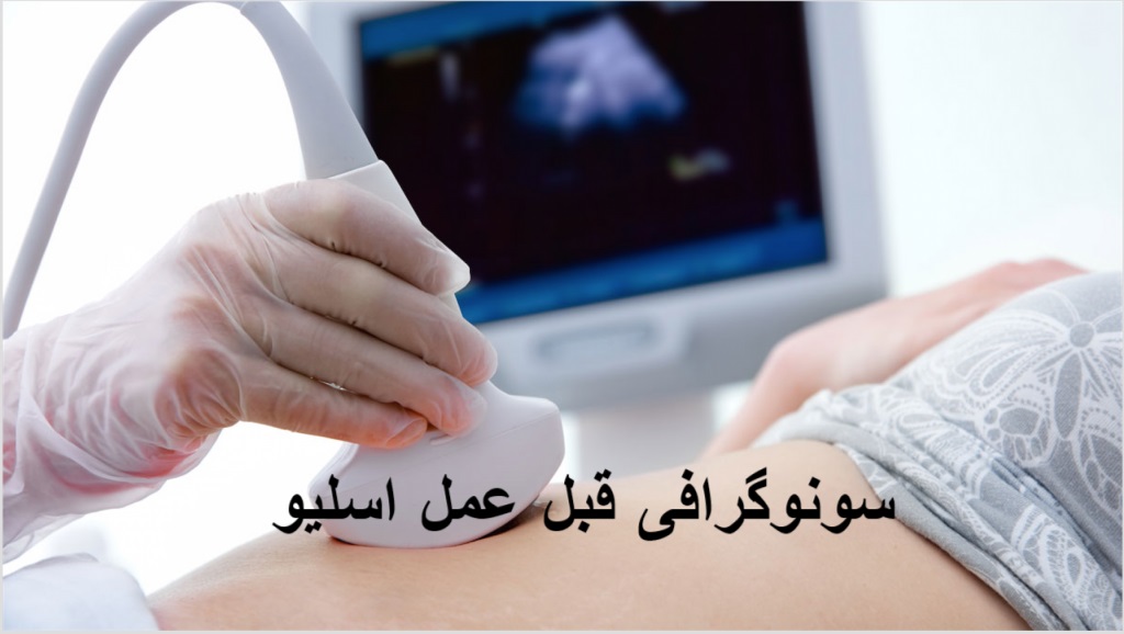 سونوگرافی قبل از عمل اسلیو معده